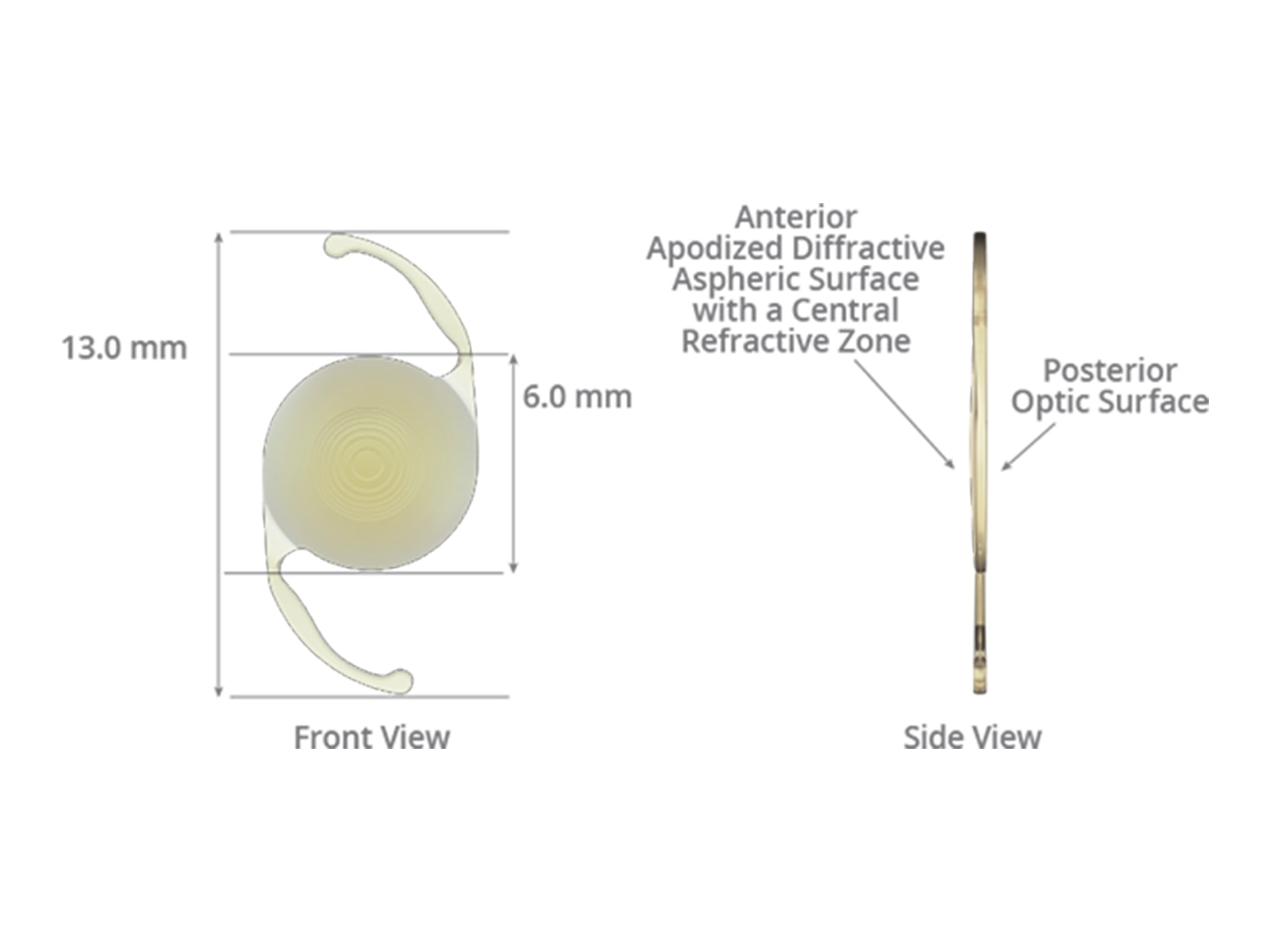 Acrysof restor lens alcon partes humanas del cuerpo